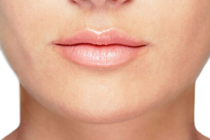 Lip Enhancement